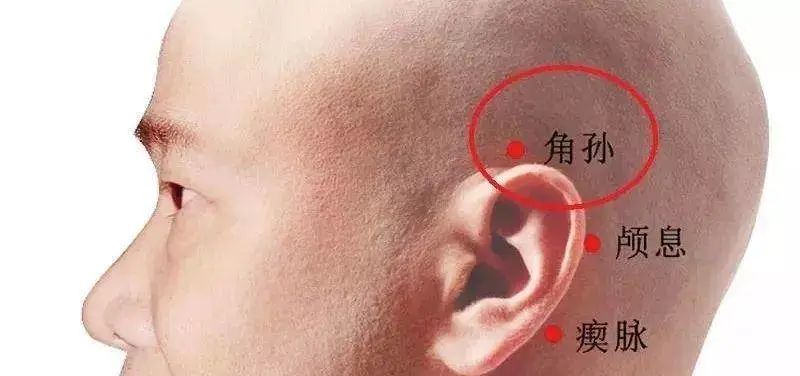 @舞蹈生：学舞蹈的千千万 ，“秃头”却不止一个~拯救发际线计划，你的秃头有救啦！