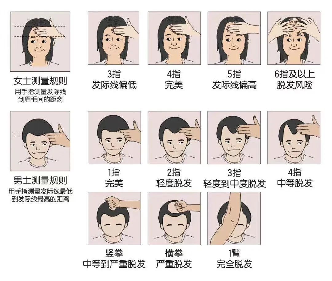 @舞蹈生：学舞蹈的千千万 ，“秃头”却不止一个~拯救发际线计划，你的秃头有救啦！