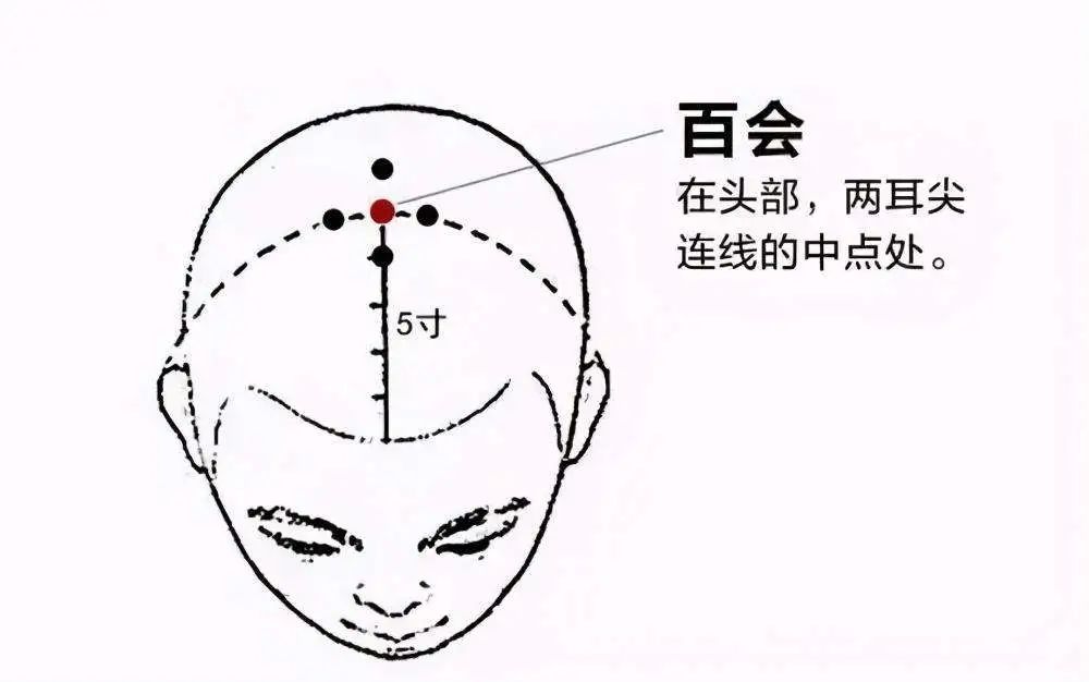 @舞蹈生：学舞蹈的千千万 ，“秃头”却不止一个~拯救发际线计划，你的秃头有救啦！